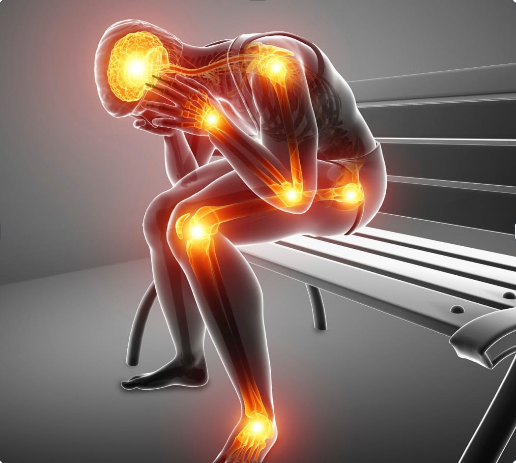 Cannabinoids and Fibromyalgia