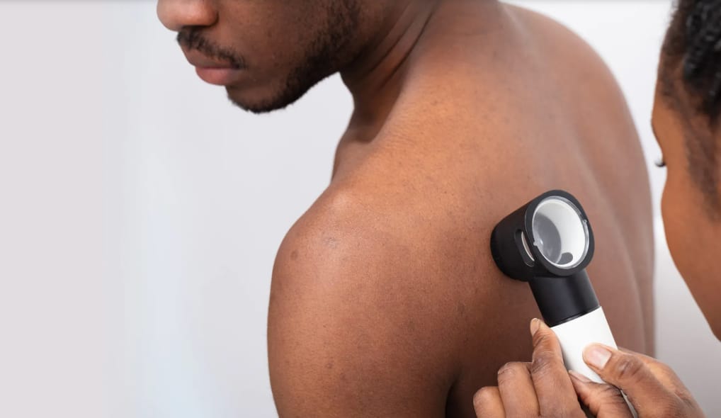 Cannabis and Dermatologic Conditions Part 2